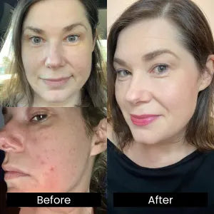 Before and after comparison of a woman's face with visible changes.