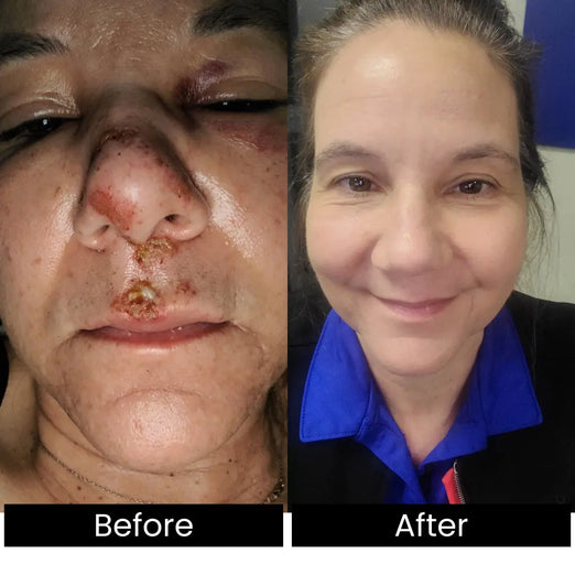 Lady Before and After