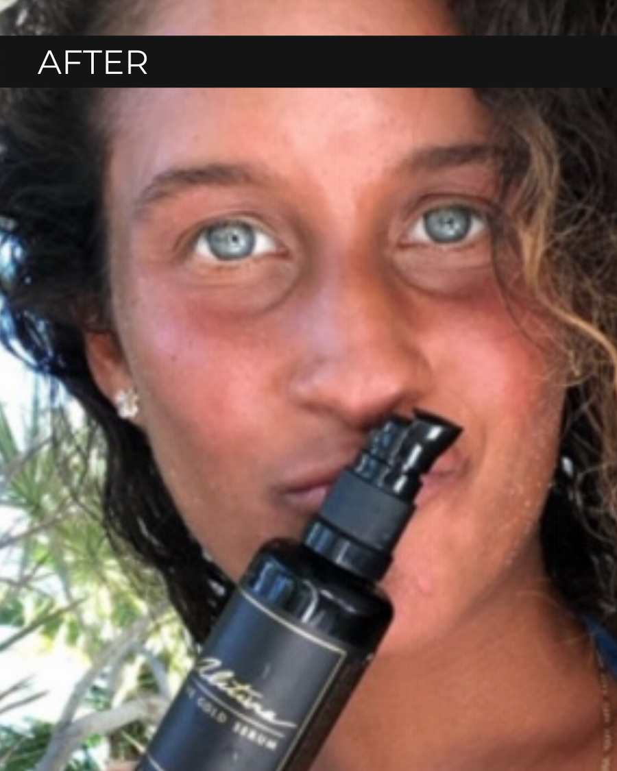 The Gold Serum Alitura