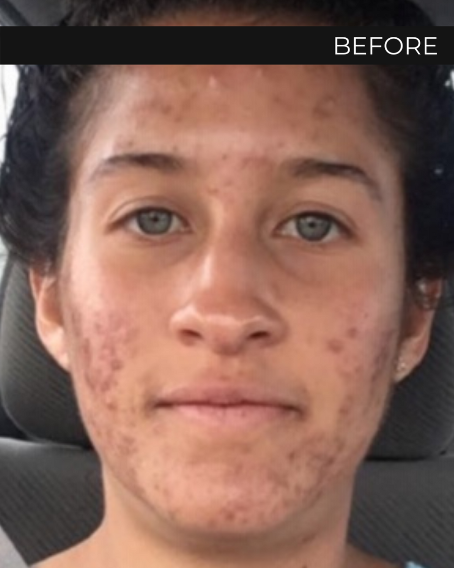 The Gold Serum Alitura